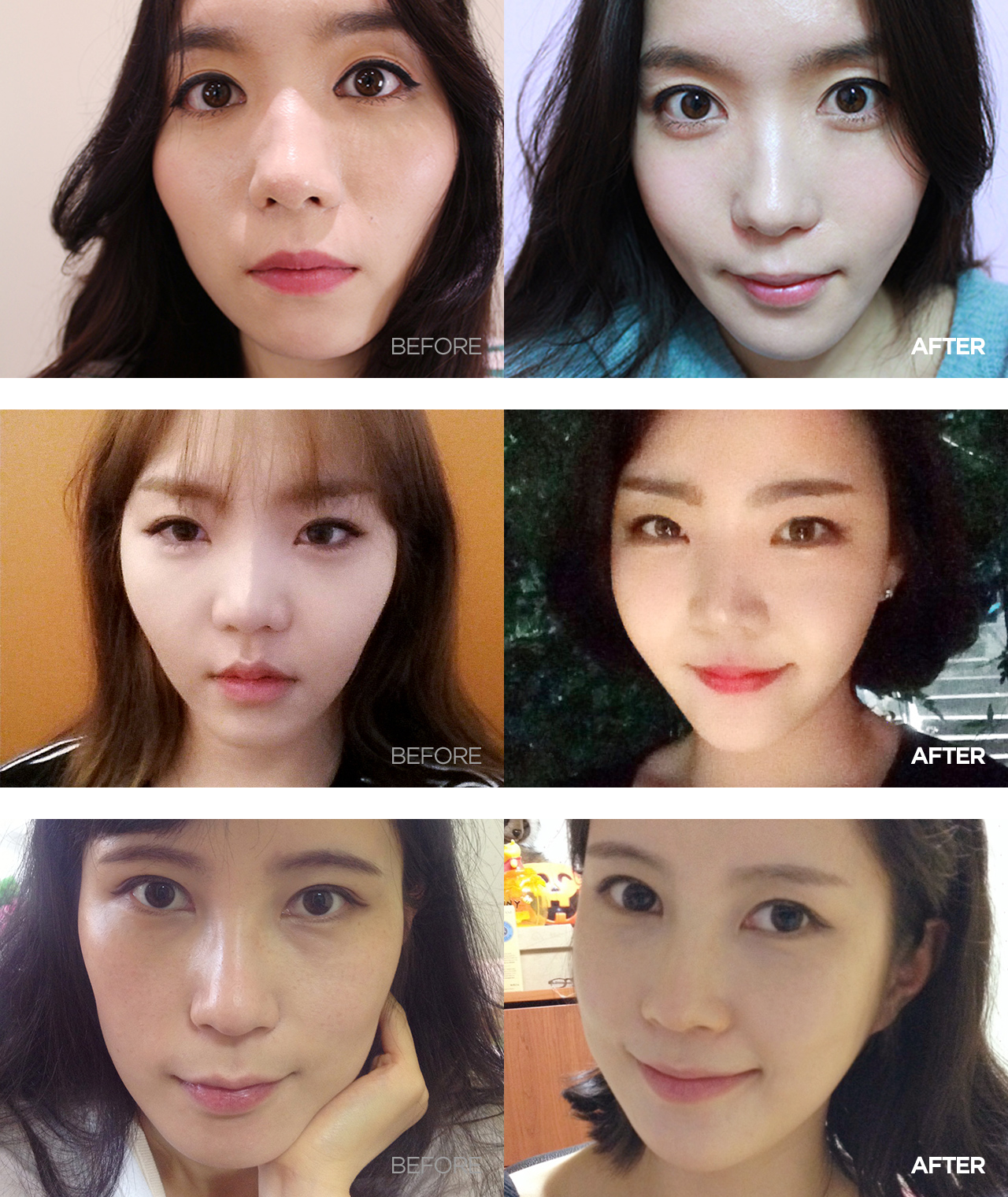 before & after
