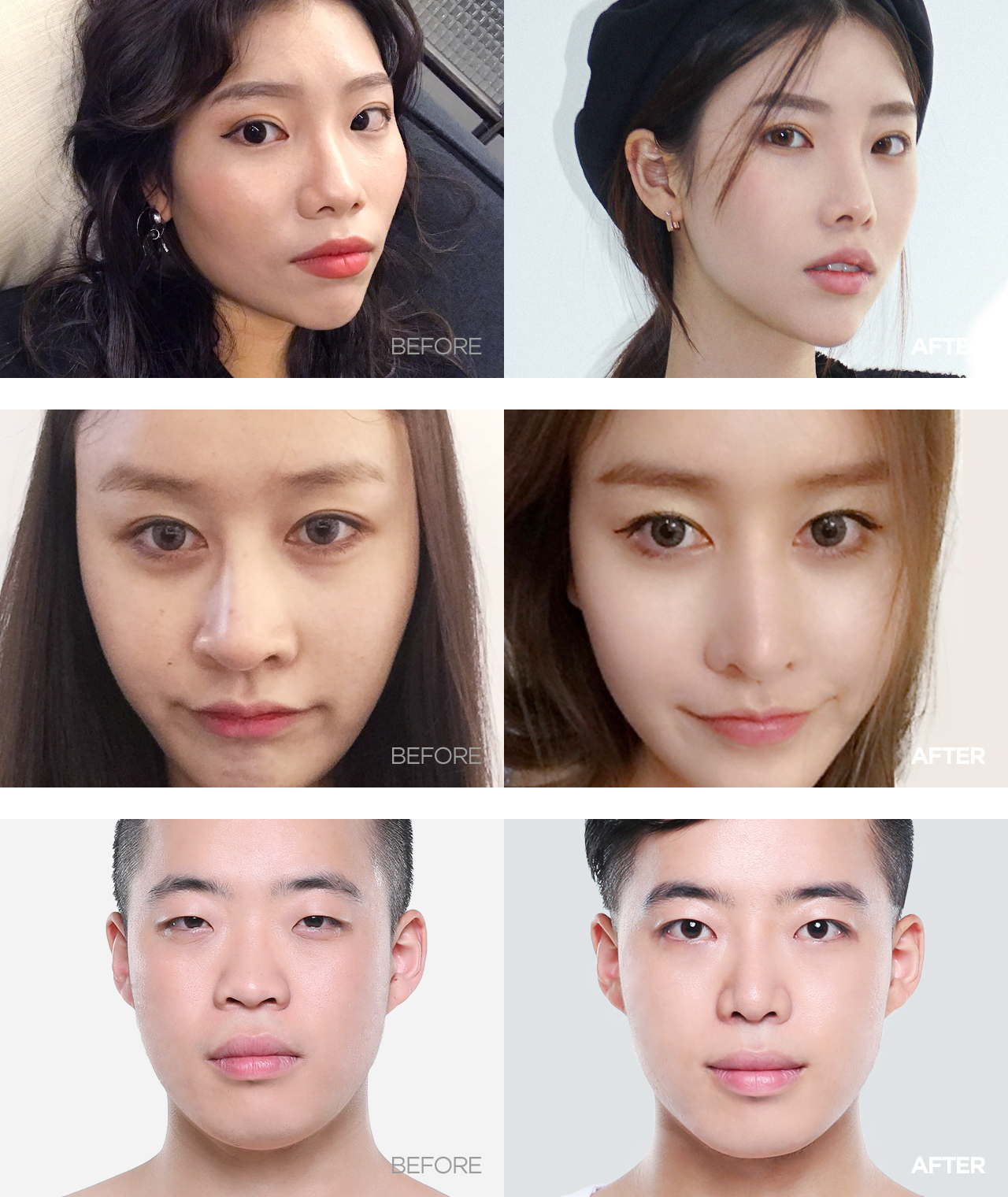 before & after